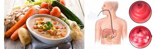 What is gastritis